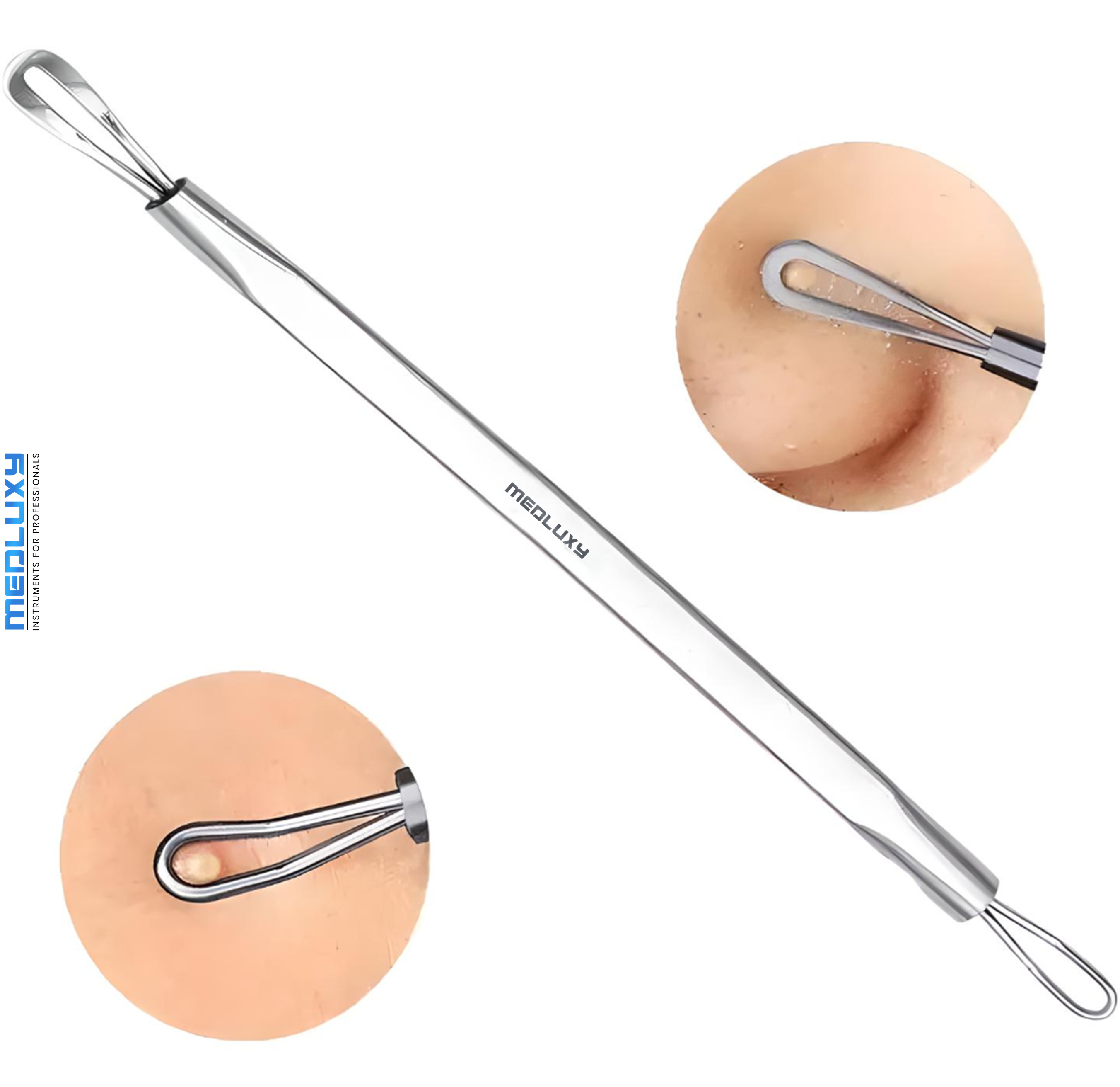 Medlxuy - Comedone extractor (blackhead remover) - Loop model - Double-sided - Wire loop and Flat spatula loop - 12 cm